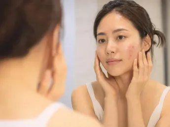 ยาแต้มสิวอักเสบ — วิธีรักษาให้ยุบไวไม่ทิ้งรอย